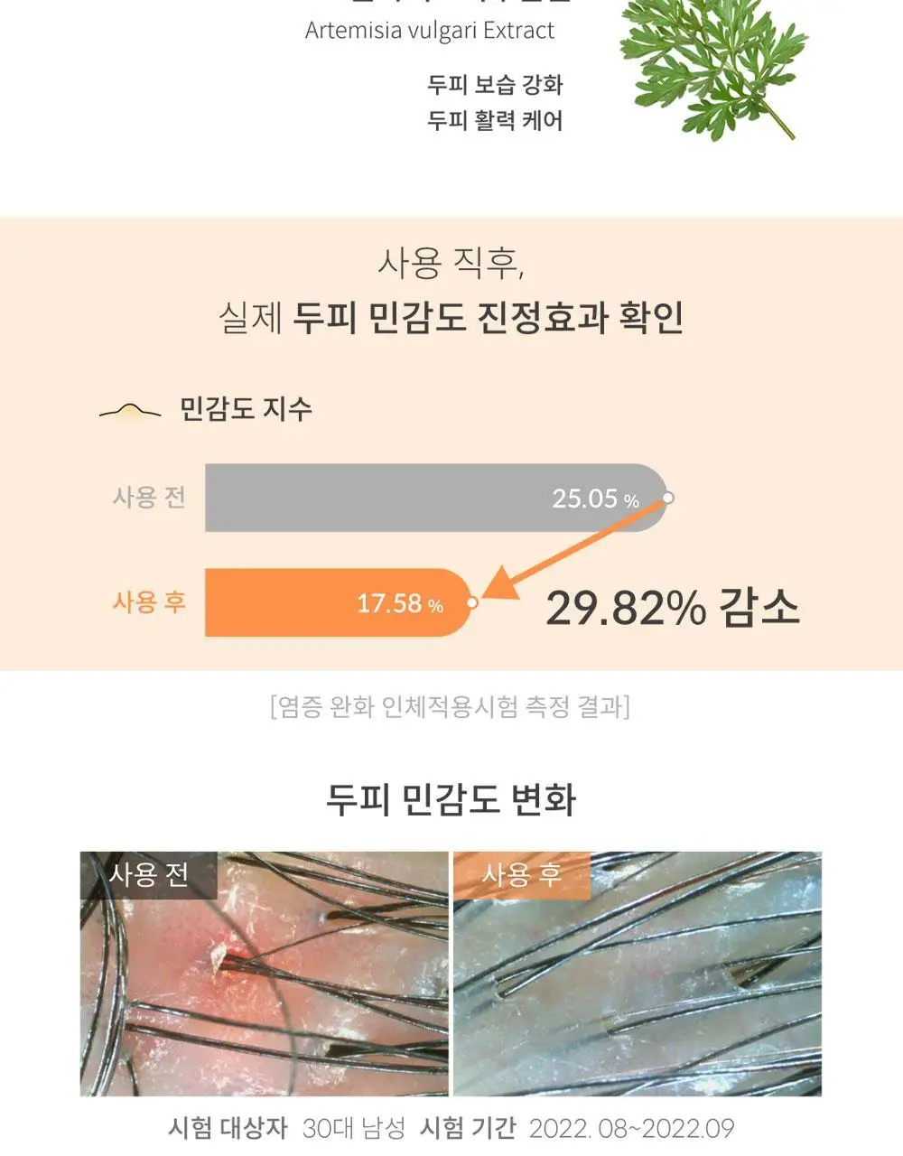 [맞춤형 탈모샴푸] 위드비컨 두피 코렉팅 샴푸 360ml(두피별 샴푸) 상세페이지 55